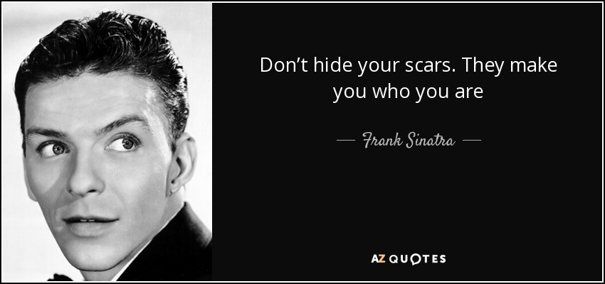 Frank Sinatra quote: Don't hide your scars. They make you who you are