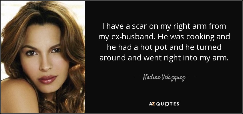 I have a scar on my right arm from my ex-husband. He was cooking and he had a hot pot and he turned around and went right into my arm. - Nadine Velazquez