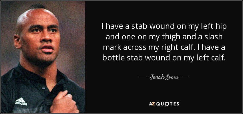 I have a stab wound on my left hip and one on my thigh and a slash mark across my right calf. I have a bottle stab wound on my left calf. - Jonah Lomu