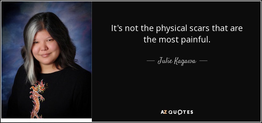 It's not the physical scars that are the most painful. - Julie Kagawa