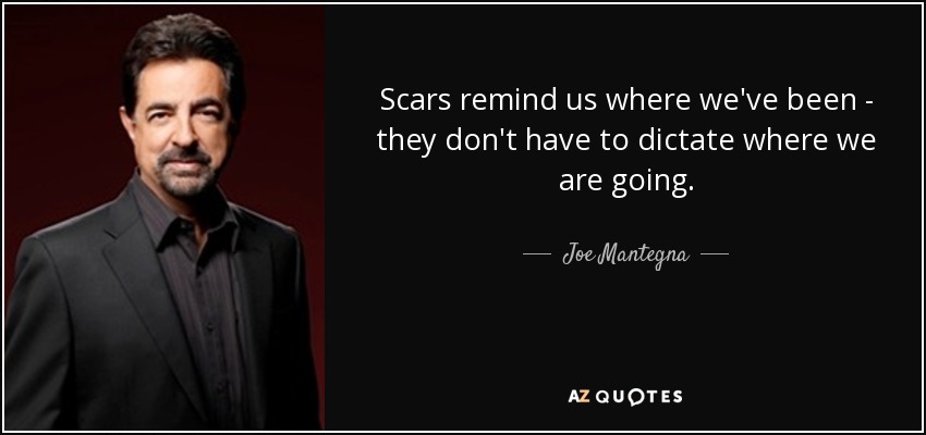 Scars remind us where we've been - they don't have to dictate where we are going. - Joe Mantegna
