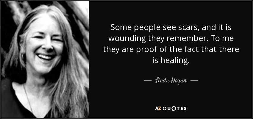Some people see scars, and it is wounding they remember. To me they are proof of the fact that there is healing. - Linda Hogan