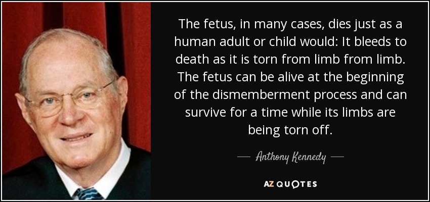 The fetus, in many cases, dies just as a human adult or child would: It bleeds to death as it is torn from limb from limb. The fetus can be alive at the beginning of the dismemberment process and can survive for a time while its limbs are being torn off. - Anthony Kennedy
