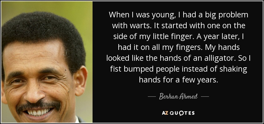 When I was young, I had a big problem with warts. It started with one on the side of my little finger. A year later, I had it on all my fingers. My hands looked like the hands of an alligator. So I fist bumped people instead of shaking hands for a few years. - Berhan Ahmed