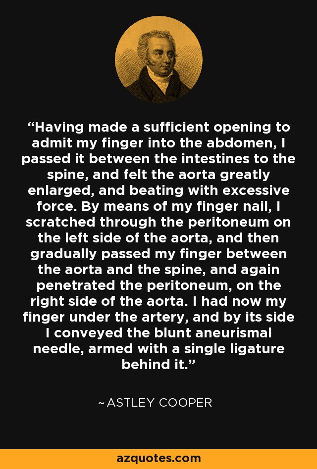 Having made a sufficient opening to admit my finger into the abdomen, I passed it between the intestines to the spine, and felt the aorta greatly enlarged, and beating with excessive force. By means of my finger nail, I scratched through the peritoneum on the left side of the aorta, and then gradually passed my finger between the aorta and the spine, and again penetrated the peritoneum, on the right side of the aorta. I had now my finger under the artery, and by its side I conveyed the blunt aneurismal needle, armed with a single ligature behind it. - Astley Cooper